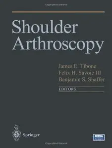 Shoulder Arthroscopy (Repost)