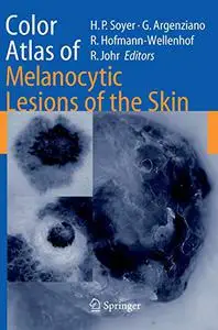 Color Atlas of Melanocytic Lesions of the Skin (Repost)