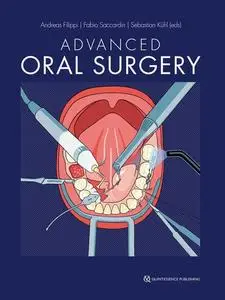 Advanced Oral Surgery