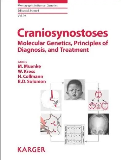 Craniosynostoses: Molecular Genetics, Principles of Diagnosis, and Treatment (repost)