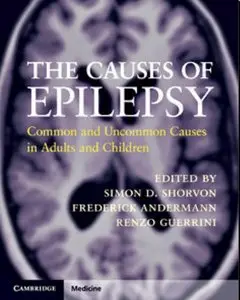 The Causes of Epilepsy: Common and Uncommon Causes in Adults and Children