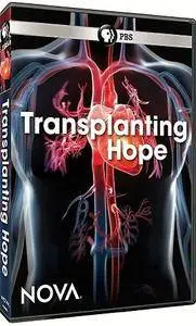 PBS NOVA - Transplanting Hope (2018)