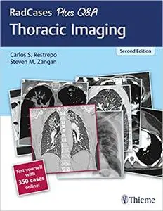 RadCases Plus Q&A Thoracic Imaging, 2nd edition