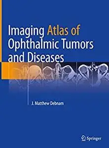 Imaging Atlas of Ophthalmic Tumors and Diseases