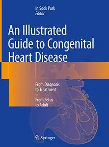 An Illustrated Guide to Congenital Heart Disease: From Diagnosis to Treatment – From Fetus to Adult (Repost)