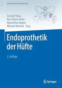 Endoprothetik der Hüfte, 2. Auflage