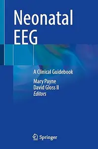 Neonatal EEG: A Clinical Guidebook