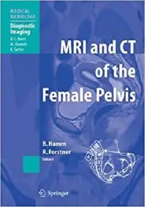 MRI and CT of the Female Pelvis (Medical Radiology)