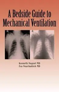 A Bedside Guide to Mechanical Ventilation (Repost)