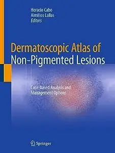 Dermatoscopic Atlas of Non-Pigmented Lesions