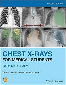 Chest X-Rays for Medical Students: CXRs Made Easy, 2nd Edition