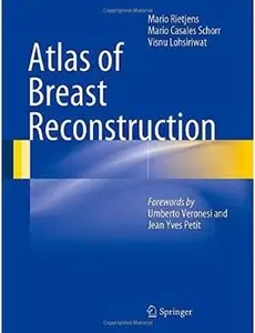 Atlas of Breast Reconstruction [Repost]