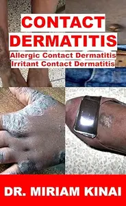 Contact Dermatitis: allergic contact dermatitis, irritant contact dermatitis