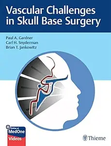 Vascular Challenges in Skull Base Surgery (repost)