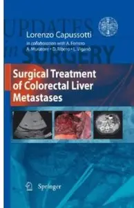 Surgical Treatment of Colorectal Liver Metastases