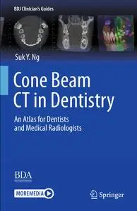 Cone Beam CT in Dentistry