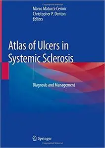 Atlas of Ulcers in Systemic Sclerosis: Diagnosis and Management