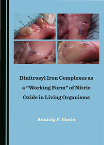 Dinitrosyl Iron Complexes As a 'Working Form' of Nitric Oxide in Living Organisms