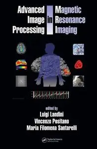Advanced Image Processing in Magnetic Resonance Imaging (Signal Processing and Communications)