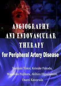 "Angiography and Endovascular Therapy for Peripheral Artery Disease" by Yoshiaki Yokoi, et al.