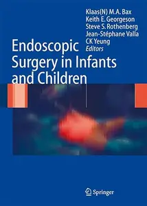 Endoscopic Surgery in Infants and Children (Repost)