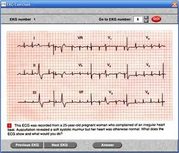 100 EKG Problems (John R. Hampton)