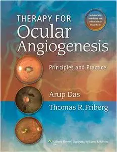 Therapy for Ocular Angiogenesis: Principles and Practice (Repost)