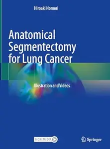 Anatomical Segmentectomy for Lung Cancer: Illustration and Videos