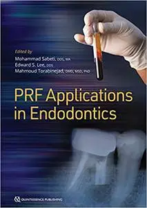 Platelet-Rich Fibrin PRF Applications in Endodontics