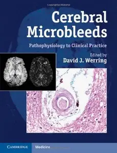 Cerebral Microbleeds: Pathophysiology to Clinical Practice (repost)