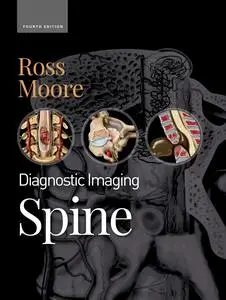 Diagnostic Imaging: Spine (4th Edition)