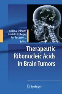 Therapeutic Ribonucleic Acids in Brain Tumors (Repost)