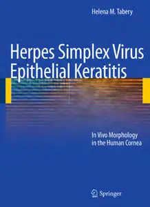 Herpes Simplex Virus Epithelial Keratitis: In Vivo Morphology in the Human Cornea (repost)