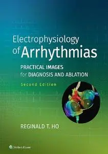 Electrophysiology of Arrhythmias: Practical Images for Diagnosis and Ablation