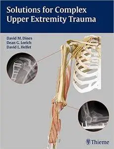 Solutions for Complex Upper Extremity Trauma