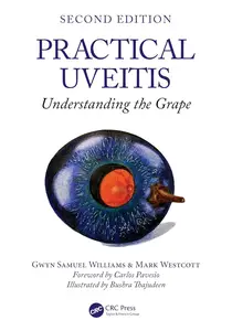 Practical Uveitis: Understanding the Grape (2nd Edition)