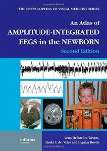 An Atlas of Amplitude-Integrated EEGs in the Newborn, Second Edition [Repost]
