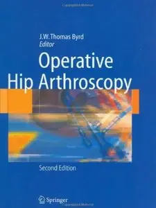 Operative Hip Arthroscopy (2nd edition)