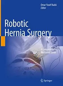 Robotic Hernia Surgery: A Comprehensive Illustrated Guide (Repost)