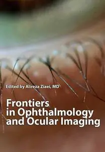 "Frontiers in Ophthalmology and Ocular Imaging" ed. by Alireza Ziaei