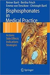 Bisphosphonates in Medical Practice Actions - Side Effects - Indications - Strategies