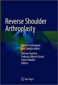 Reverse Shoulder Arthroplasty: Current Techniques and Complications