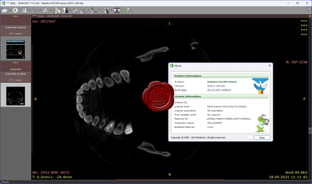 RadiAnt DICOM Viewer 2023.1 (x64)