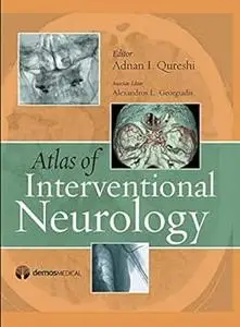 Atlas of Interventional Neurology