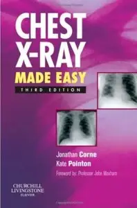 Chest X-Ray Made Easy (3rd edition) [Repost]