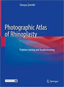 Photographic Atlas of Rhinoplasty: Problem-solving and Troubleshooting