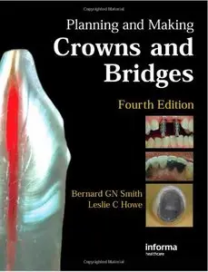 Planning and Making Crowns and Bridges (repost)