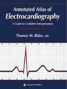 Annotated Atlas of Electrocardiography: A Guide to Confident Interpretation (Repost)