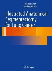Illustrated Anatomical Segmentectomy for Lung Cancer [Repost]