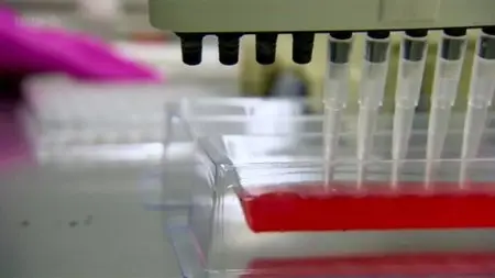 BBC - Winter Viruses and How to Beat Them (2013)